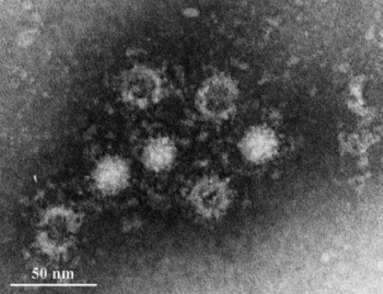 E型肝炎ウイルス